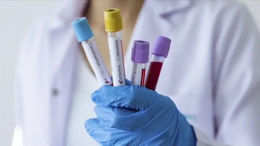 Zonguldak geneli vaka sayısı 370 oldu