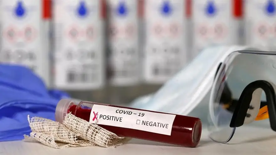 Koronavirüs şüphesi ile 4 Kişi hastaneye yatırıldı