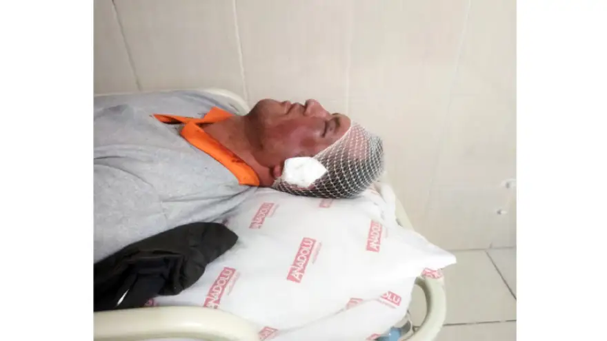 Belediye temizlik işçisi saldırıya uğradı..