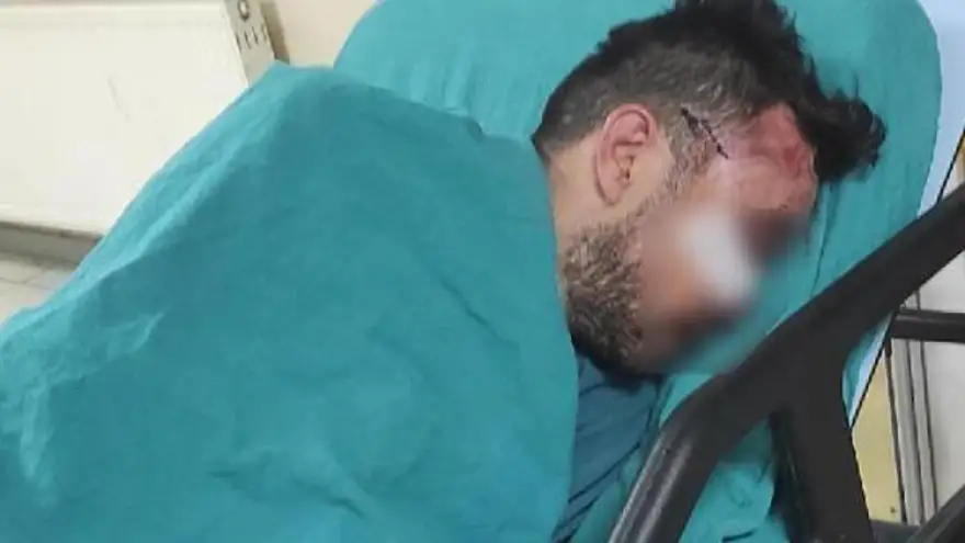 Cinsel taciz de bulundu tekme tokat dövüldü