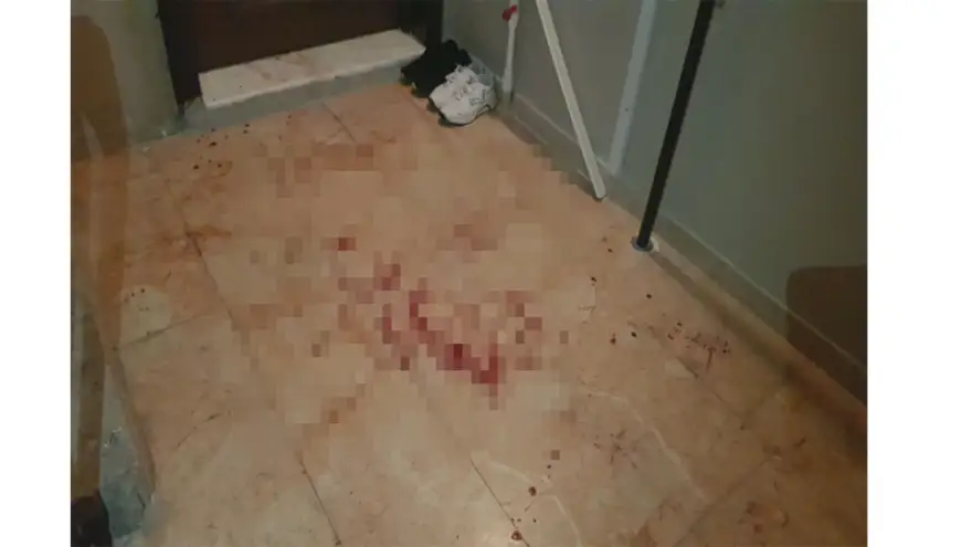 Bıçaklı saldırıya uğradı...