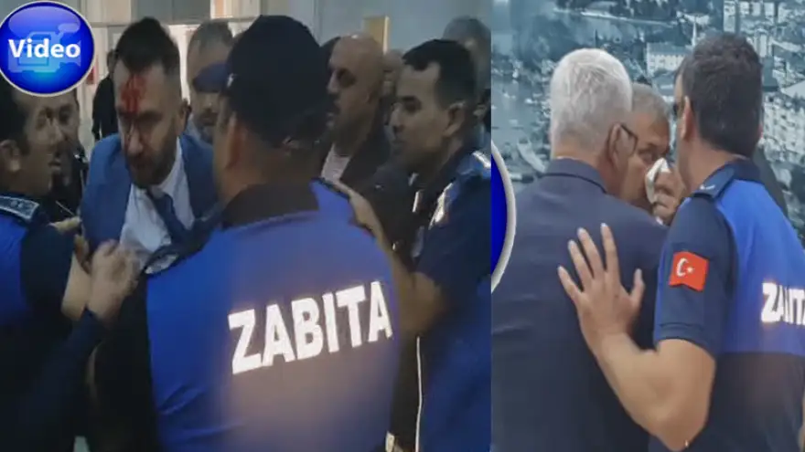 Meclis toplantısında kan aktı